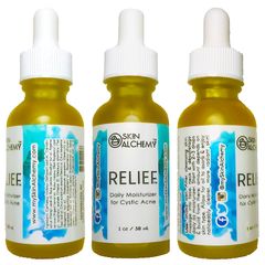 skinalchemy relief